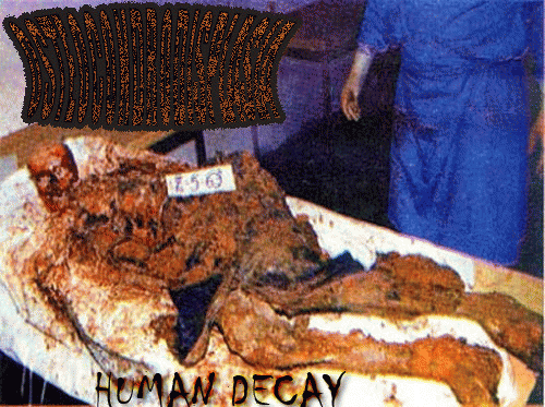Osteocondrodisplasia : Human Decay